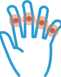 Icon of hand showing joint irritation or swelling. Please refer to list of full indications.